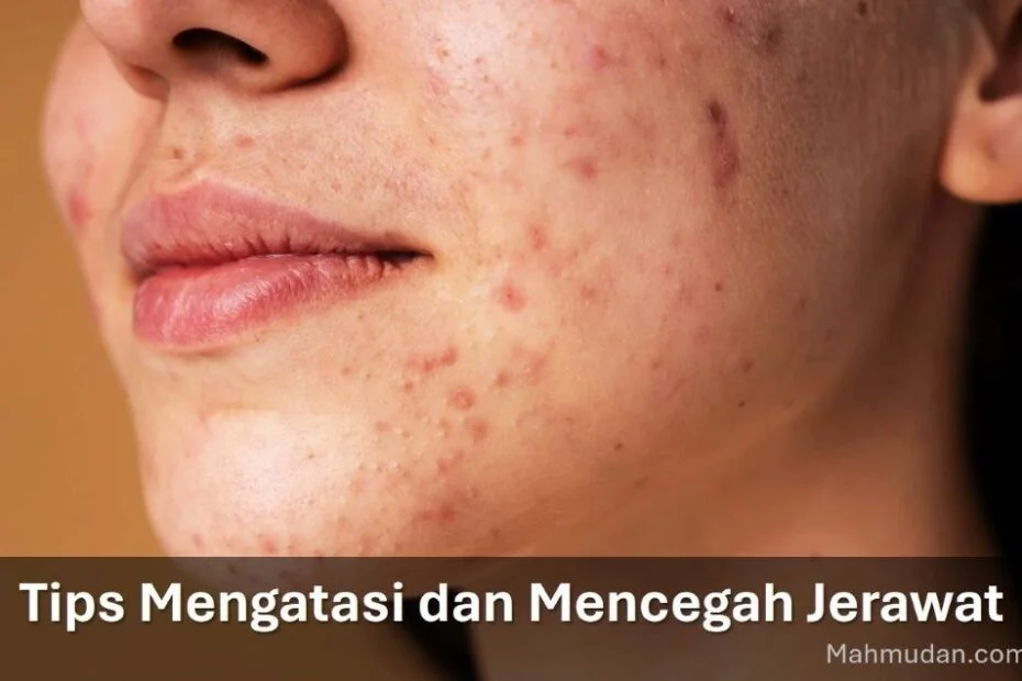 tips mencegah jerawat